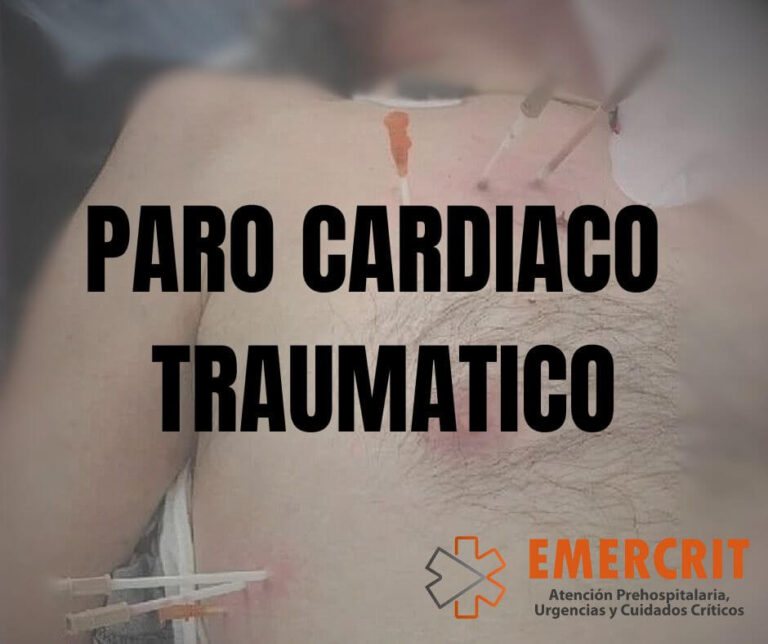 PARO-CARDIACO-TRAUMATICO-768x644-1